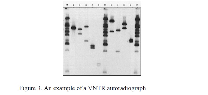 VNTR autoradiograph